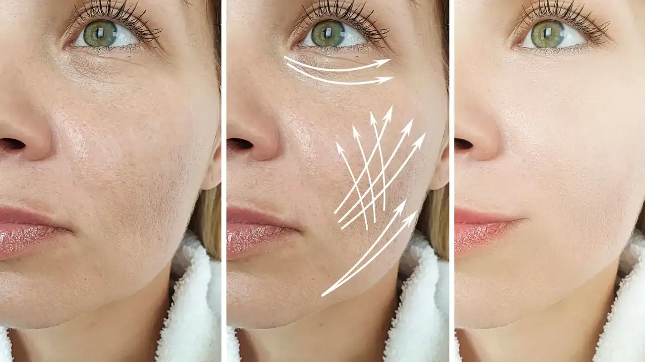 Can One Treatment Really Tackle More Than One Skin Concern Sheffield?