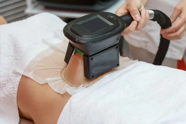 Image of person having fat freezing treatment to help weight gain Sheffield