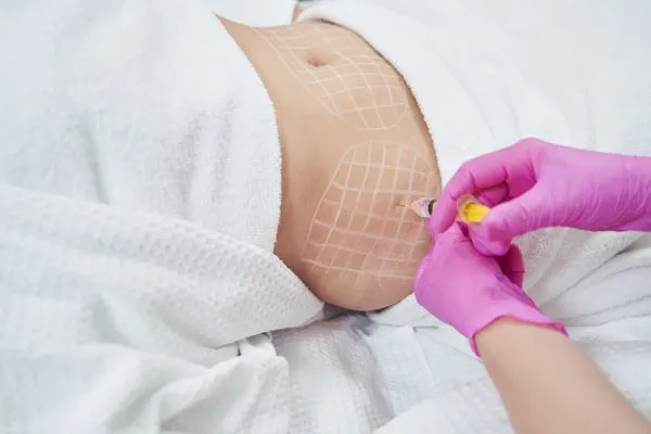 image of fat dissolving injections on love handles to help combat weight gain Sheffield