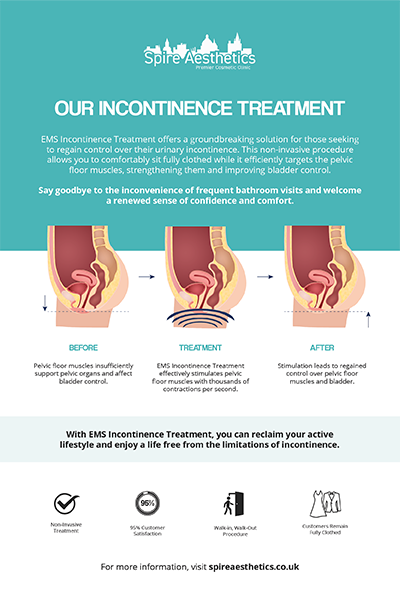 image of how urge incontinence Sheffield treatment works
