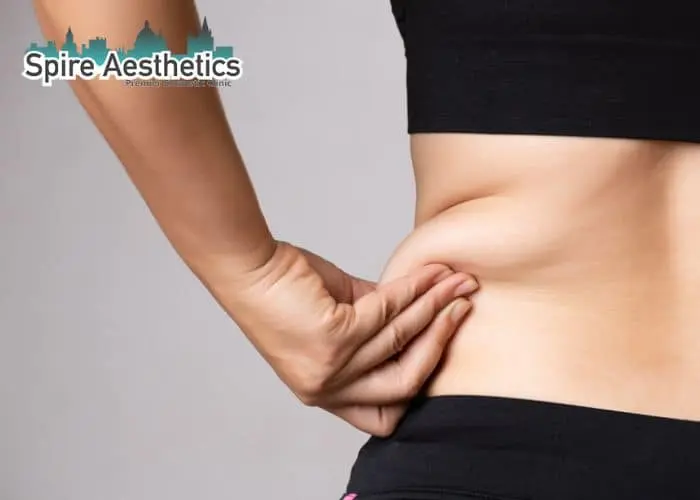 Image of woman pinching fat on their hips Sheffield. Fat Freezing treatment