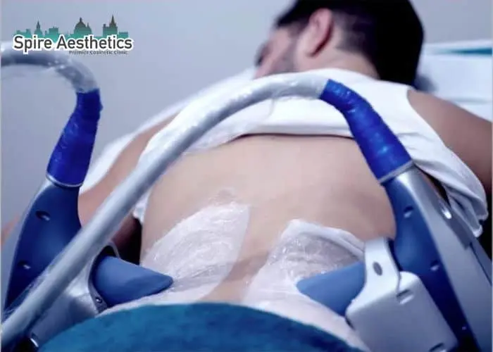 Man having fat freezing treatment done on love handles before a competitions Sheffield to create a sculpted look.
