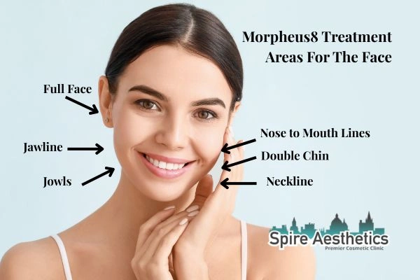 Where can Morpheus8 Treatment Sheffield be done on the body?