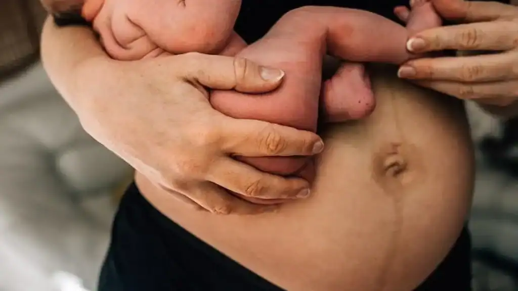 Why Is My Stomach Still Big After Pregnancy Sheffield?